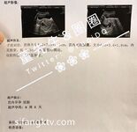 北京一对夫妻私房照泄露